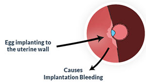 spotting pregnant implantation bleeding